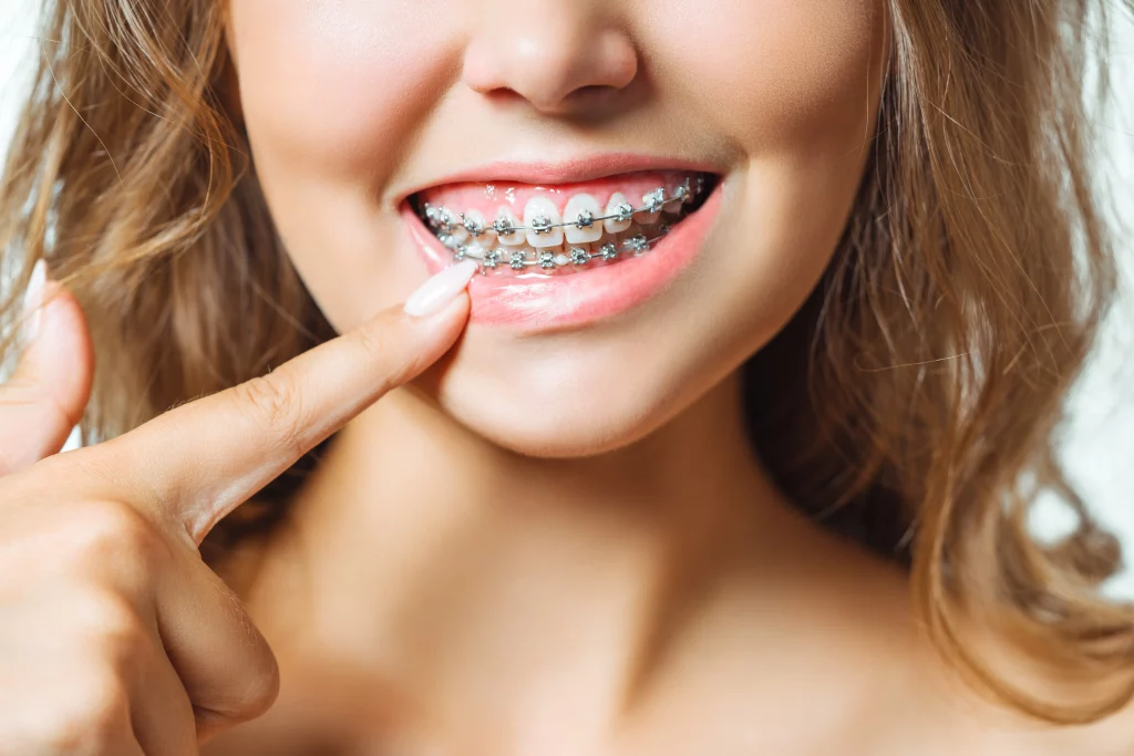 Ortodoncja w Lubinie – pacjent podczas leczenia aparatem ortodontycznym w klinice Lookdent