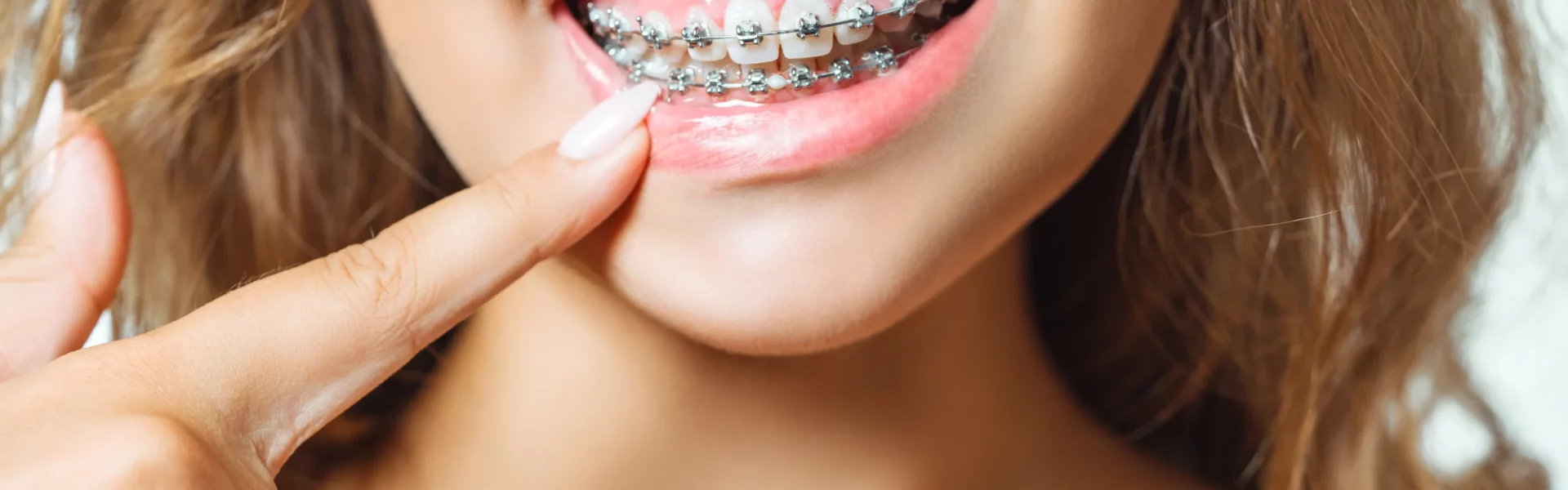 Ortodoncja w Lubinie – pacjent podczas leczenia aparatem ortodontycznym w klinice Lookdent